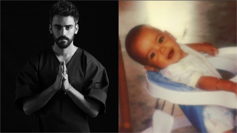 diego amozorrutia antes y despues